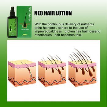 Neo Hair Regrowth Spray Lotion for Men & Women with Natural Herbal Extract Essential Oil | The Savior of Hair Loss - 120 ml