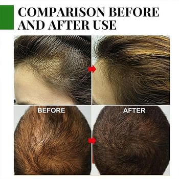 60ml Rosemary Hair Care Essential Oil | Anti Hair Loss Serum | Essential Oil for Damaged Hair | Serum for Hair Repair and Care