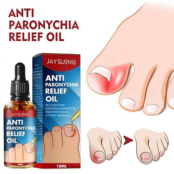 Anti Paronychia Relief Oil, Ingrown Toenail Drops, Anti Fungal Toe Nail Ingrown Corrector, Stop Pain Onychomycosis Treatment Serum (10ml)