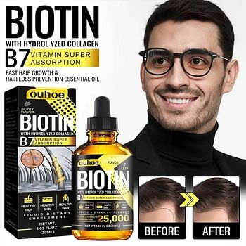 Biotin Hair Regrowth Serum - Hair Thinning and Anti Hair Loss Oil - 30 ml