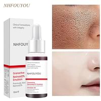 Facial Serum Replenishment Moisturize Shrink Pores, Remove Blackheads and Whiteheads, Repaired Damaged Skin