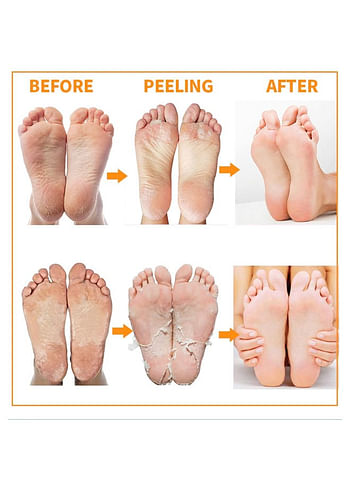 Foot Peeling and Exfoliating Mask, Dead Skin Removing Sock - Olive