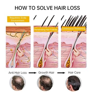 PURC Anti Hair Loss and Hair Growth Serum for Men and Women