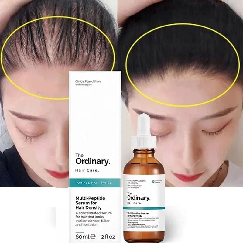 The Ordinary Multi-Peptide Serum for Hair Growth, Density and Hair Loss | Hair Growth Essential Oil Serum for Thicker, Denser, Fuller, and Healthier - 60 ml