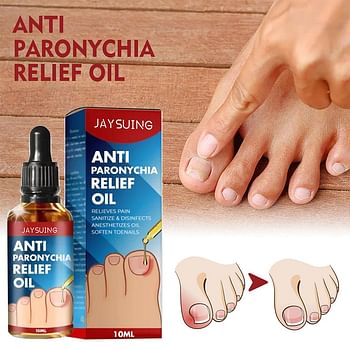 Anti Paronychia Relief Oil, Ingrown Toenail Drops, Anti Fungal Toe Nail Ingrown Corrector, Stop Pain Onychomycosis Treatment Serum (10ml)