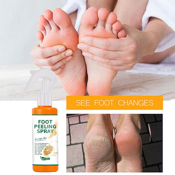 Moisturizing and Hydrating Foot Peeling Spray Mask | Dead Skin Calluses Foot Mask | Anti-Cracked Heel Enhancer and Feet Care - 100 ml