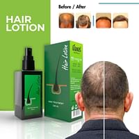 Neo Hair Regrowth Spray Lotion for Men & Women with Natural Herbal Extract Essential Oil | The Savior of Hair Loss - 120 ml