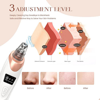 2024 Newest Blackhead Remover Pore Cleaning - Facial Pore Cleaner-5 Suction Power - USB Rechargeable - Electric Acne Extractor Tool for Adult