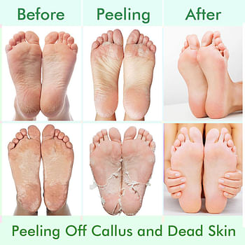 Moisturizing Foot Mask, Foot Mask for Legs Feet Mask Scrub Exfoliating Foot Mask Remove Dead Skin Foot Patch