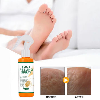 Moisturizing and Hydrating Foot Peeling Spray Mask | Dead Skin Calluses Foot Mask | Anti-Cracked Heel Enhancer and Feet Care - 100 ml