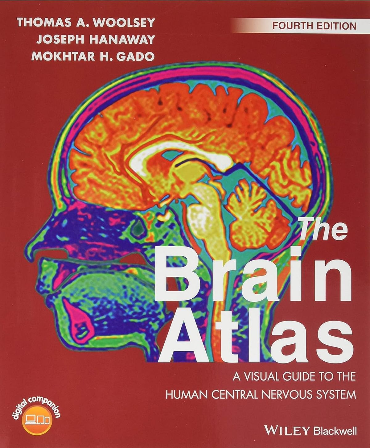 The Brain Atlas: A Visual Guide to the Human Central Nervous System by Thomas A. Woolsey (Author), Joseph Hanaway (Author), Mokhtar H. Gado (Author)