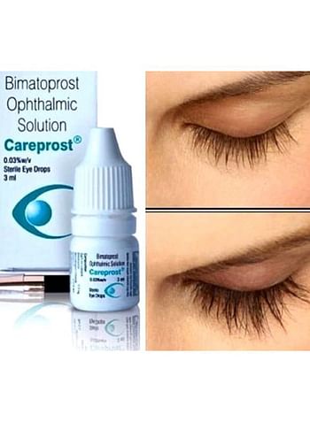Bimatoprost Ophthalmic Solution Eye Drop 3ml