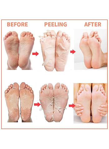 Foot Peeling and Exfoliating Mask, Dead Skin Removing Sock - Rose