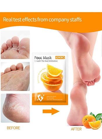 Foot Peeling and Exfoliating Mask, Dead Skin Removing Sock - Rose