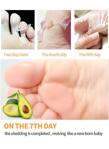 Foot Peeling and Exfoliating Mask, Dead Skin Removing Sock - Avocado