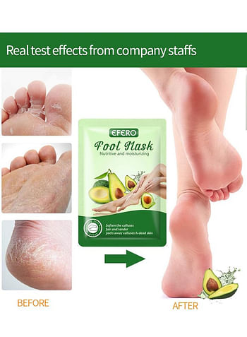 Foot Peeling and Exfoliating Mask, Dead Skin Removing Sock - Olive