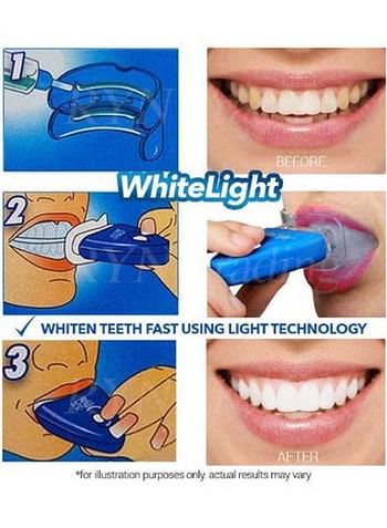 White Light Tooth Whitening System White