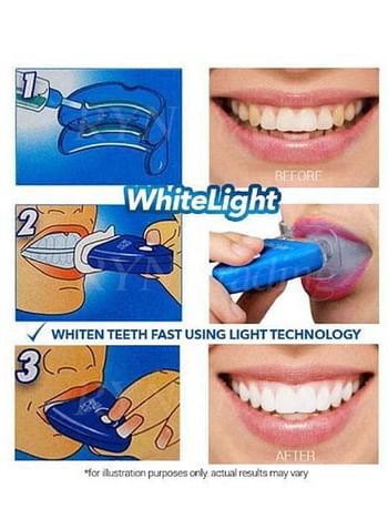 Whitelight Instant Teeth Whitening Device Blue/Clear 300grams